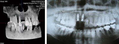 CT�A�����g�Q���B�e