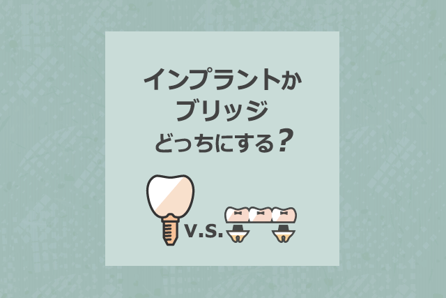 インプラントかブリッジどっちにする?
