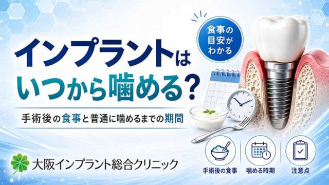 インプラントはいつから噛める？手術後の食事と普通に噛めるまでの期間