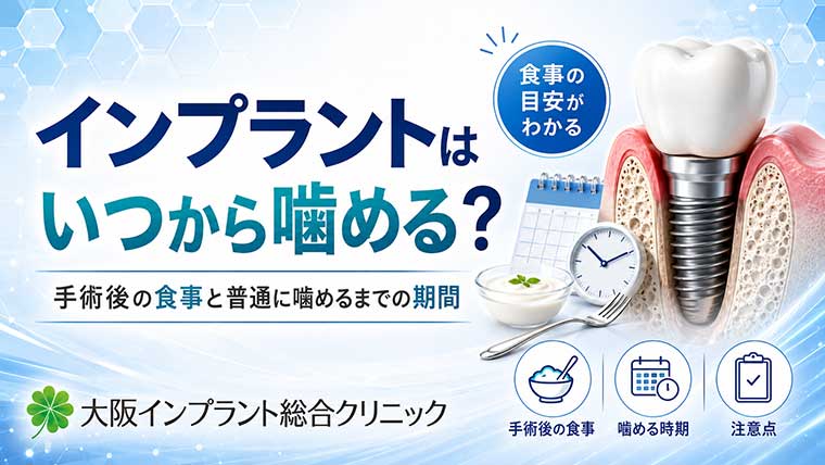 インプラントはいつから噛める？手術後の食事と普通に噛めるまでの期間