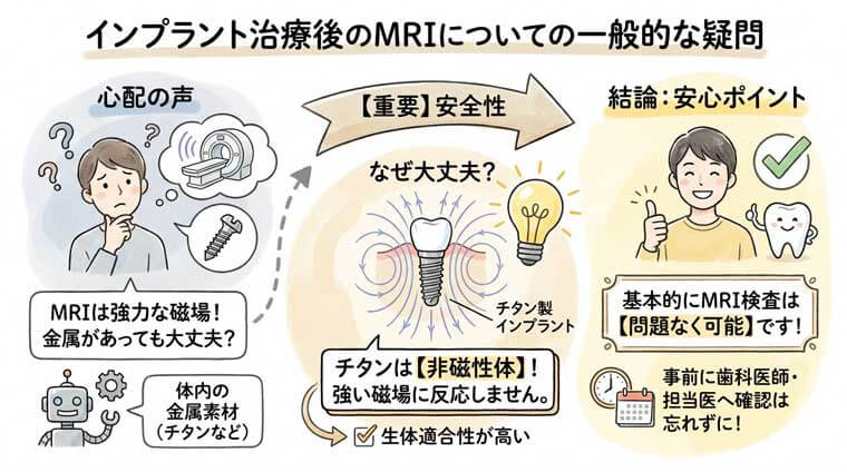 インプラント治療後のMRIについての一般的な疑問の図解