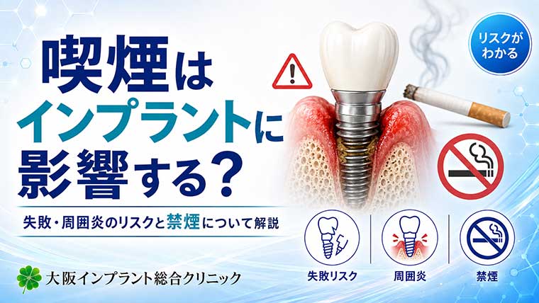 喫煙はインプラントに影響する？失敗・周囲炎のリスクと禁煙について解説