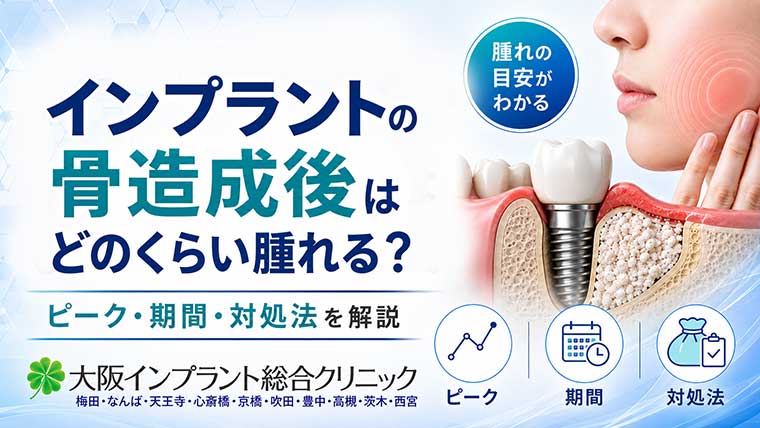 インプラントの骨造成後はどのくらい腫れる？ピーク・期間・対処法を解説