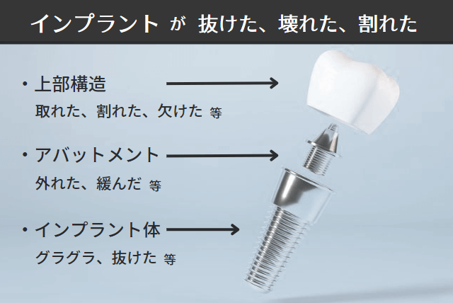 インプラントが抜けた、割れた、欠けた