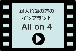 【動画】総入れ歯の方のインプラントAll on 4