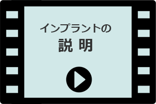 【動画】インプラントの説明