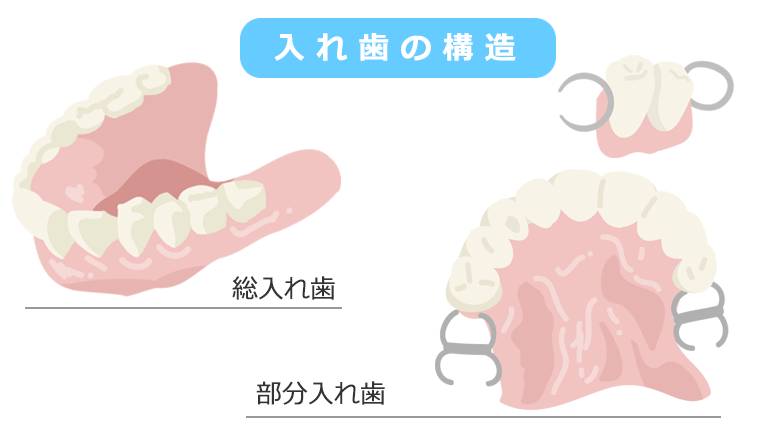 入れ歯の構造