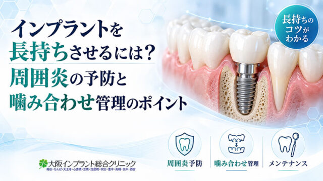 インプラントを長持ちさせるには？周囲炎の予防と噛み合わせ管理のポイント