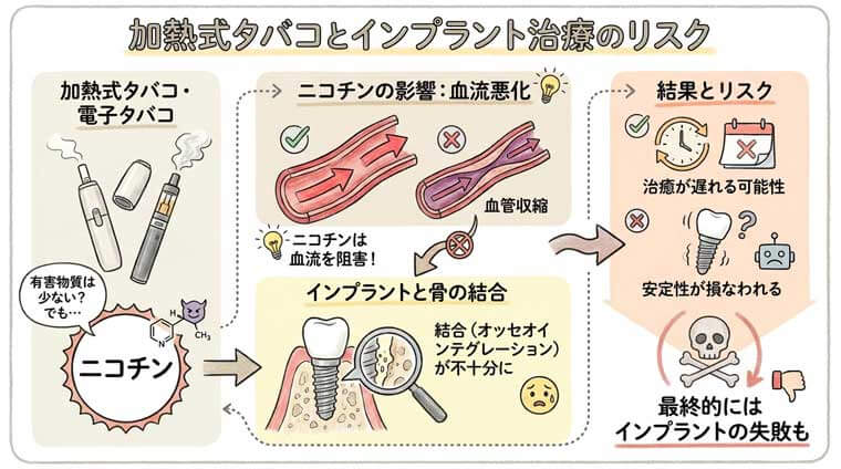 加熱式タバコとインプラント治療のリスクの図解