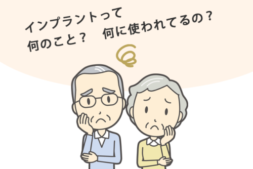 インプラントって何?何に使われるの?