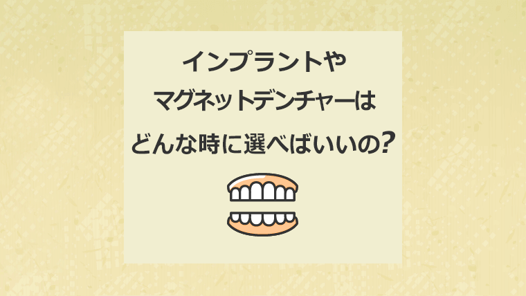 インプラントやマグネットデンチャーはどんな時に選べばいいの？