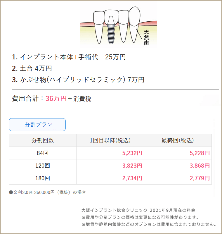 インプラント1本の価格