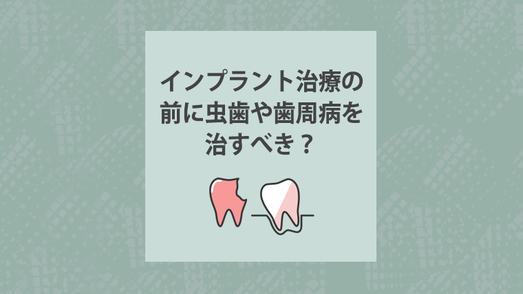 インプラント治療の前に虫歯や歯周病を治すべき？