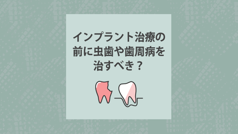 インプラント治療の前に虫歯や歯周病を治すべき?