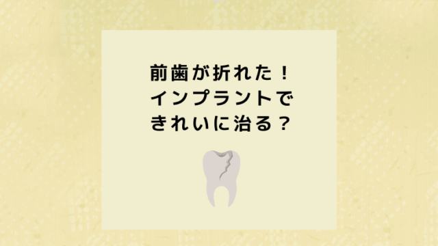 前歯が折れた！インプラントできれいに治る？