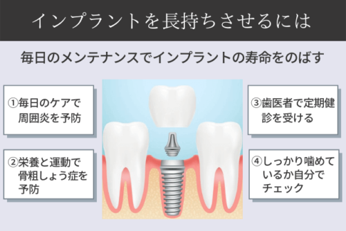 インプラントを長もちさせるためのポイント