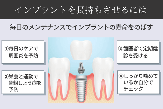 インプラントを長もちさせるためのポイント