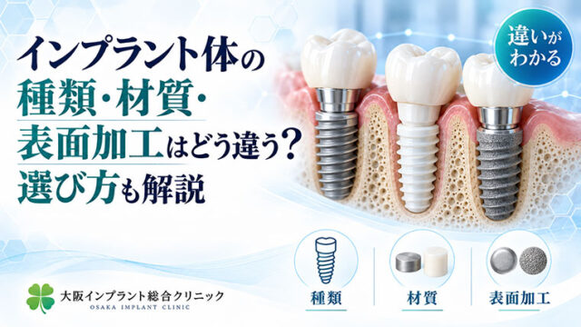 インプラント体の種類・材質・表面加工はどう違う？選び方も解説
