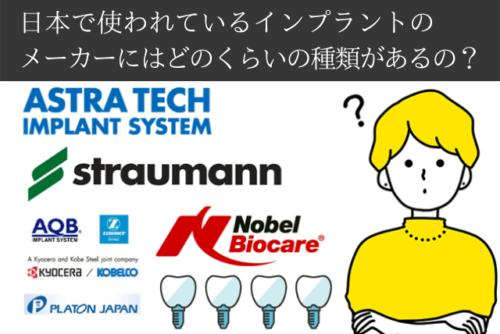 日本で使われているインプラントメーカー