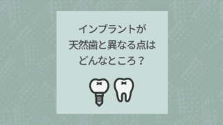 インプラントが天然歯と異なる点はどんなところ？