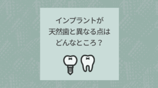 インプラントが天然歯と異なる点はどんなところ?