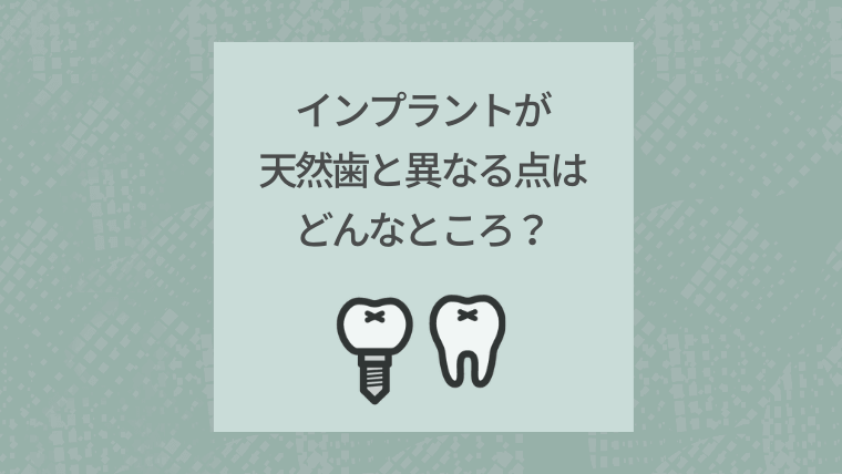 インプラントが天然歯と異なる点はどんなところ?