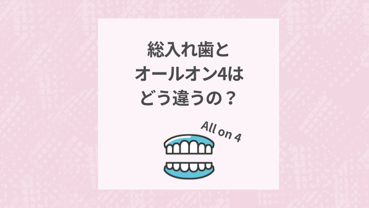 総入れ歯とオールオン4はどう違うの？