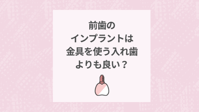 前歯のインプラントは金具を使う入れ歯よりも良い？