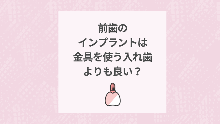 前歯のインプラントは金具を使う入れ歯よりも良い？