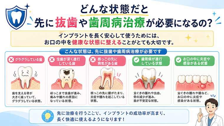 どんな状態だと先に抜歯や歯周病治療が必要になるの？の図解