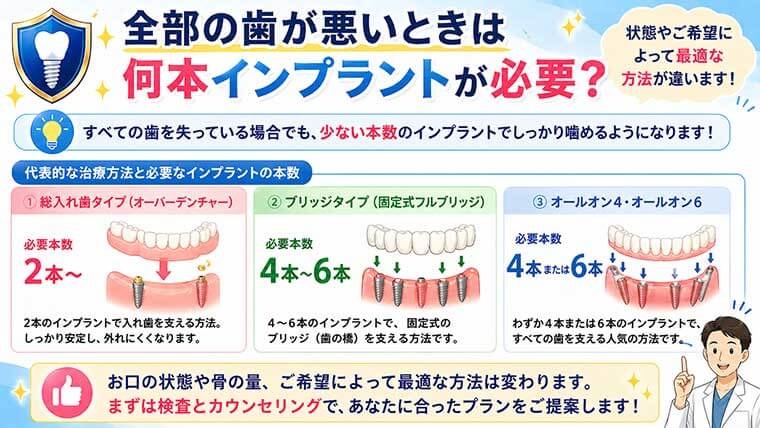全部の歯が悪いときは何本インプラントが必要？の図解