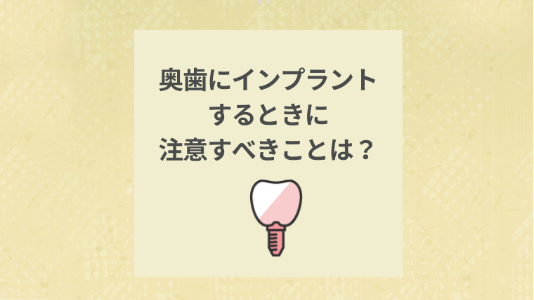 奥歯にインプラントするときに注意すべきことは?