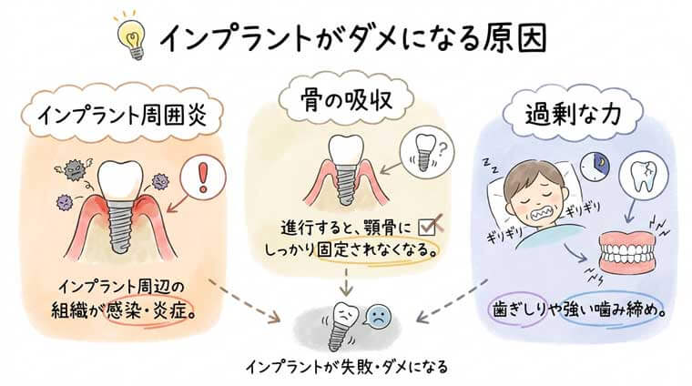 インプラントがダメになる原因の図解