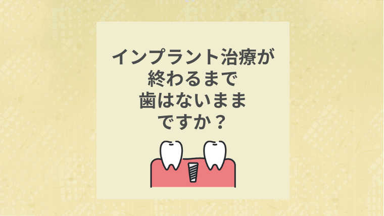 インプラント治療が終わるまで歯はないままですか？