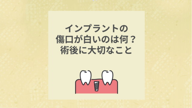 インプラントの傷口が白いのは何？術後に大切なこと