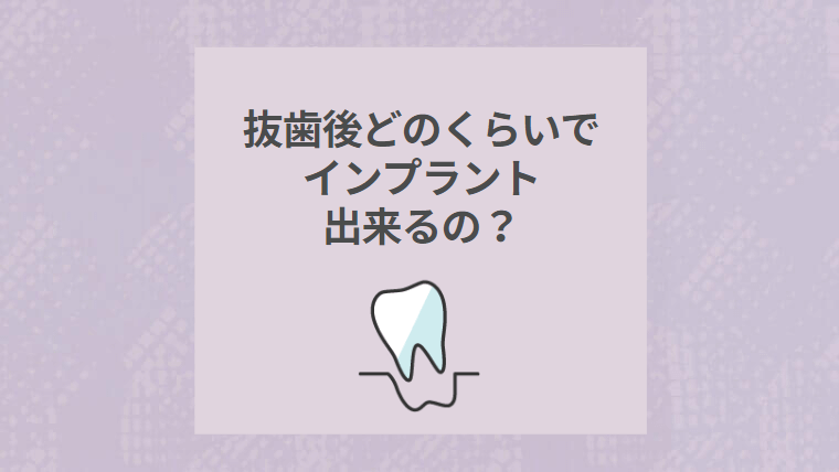 抜歯後どのくらいでインプラント出来るの？