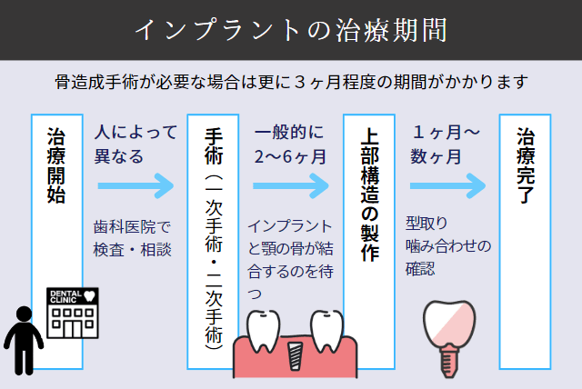 インプラントの治療期間