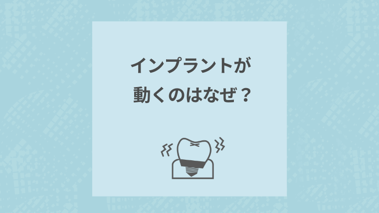 インプラントが動くのはなぜ?