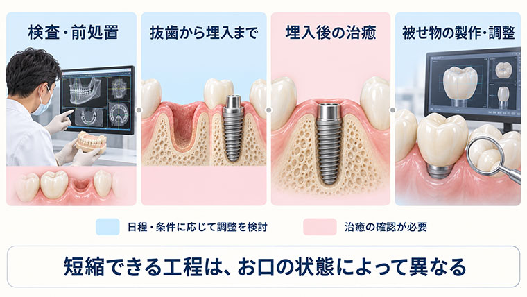 インプラントの治療期間を短縮
