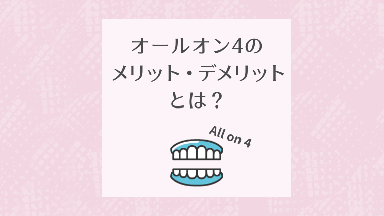 オールオン4のメリット・デメリットとは？