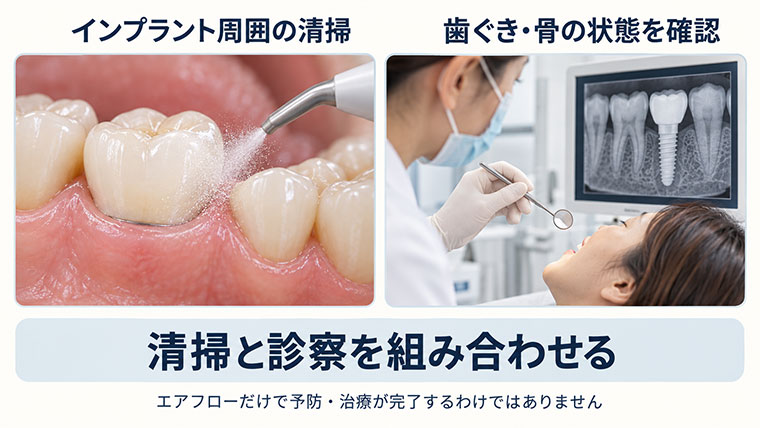 エアフローと診療