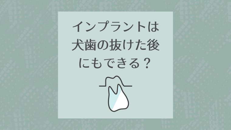 インプラントは犬歯の抜けた後にもできる？