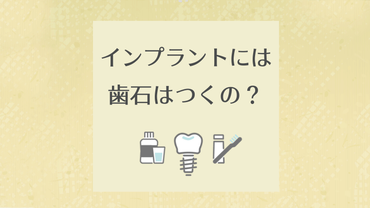 インプラントには歯石はつくの？