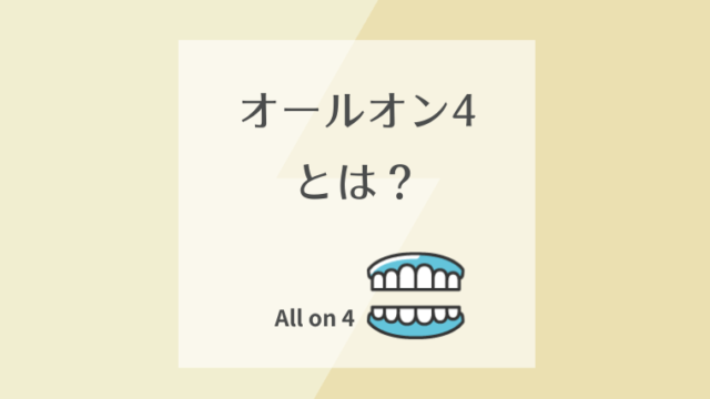 オールオン4とは？
