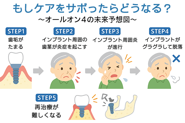 ケアをさぼったら