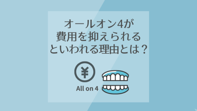 オールオン4が費用を抑えられるといわれる理由とは？