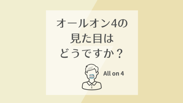 オールオン4の見た目はどうですか？