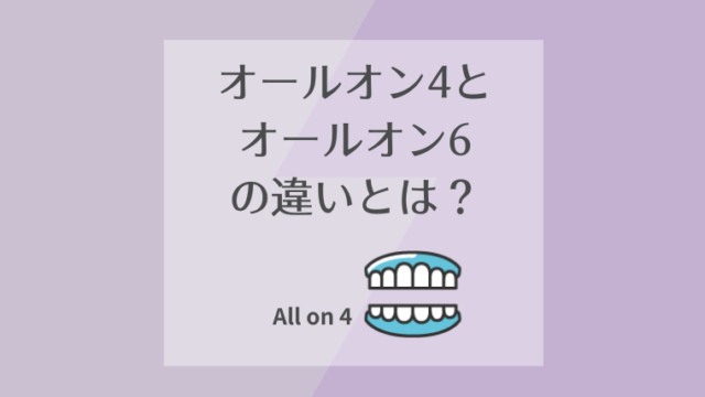 オールオン4とオールオン6の違いとは？