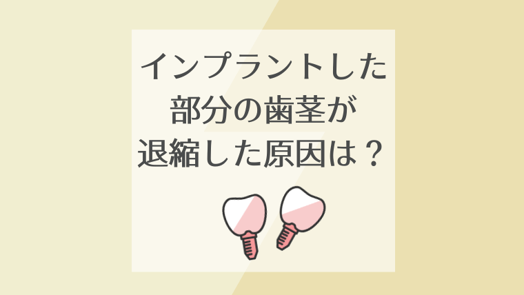 インプラントした部分の歯茎が退縮した原因は？
