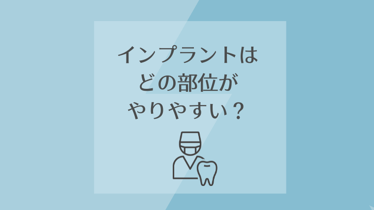 インプラントはどの部位がやりやすい?